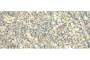 Immunohistochemistry of paraffin-embedded Human tonsil tissue using TMEM9 Polyclonal Antibody at dilution of 1:50(x200) (TMEM9 抗体)