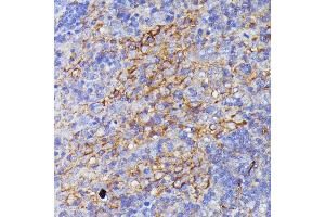 Immunohistochemistry of paraffin-embedded rat lymph node using SN antibody (ABIN7270670) at dilution of 1:100 (40x lens). (SNAP23 抗体  (AA 1-211))