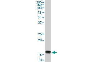 ACP1 monoclonal antibody (M01), clone 4B10. (ACP1 抗体  (AA 1-158))