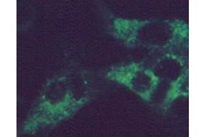 Immunofluorescence using MAb-G-1 on RSV infected HEp-2 cells (Respiratory Syncytial Virus Long Strain (RSV Long) 抗体)