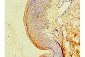 Immunohistochemistry of paraffin-embedded human skin tissue using ABIN7146714 at dilution of 1:100 (CA14 抗体  (AA 16-290))