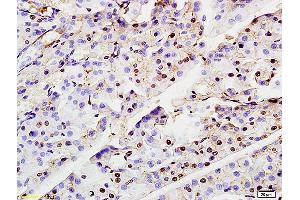 Formalin-fixed and paraffin embedded rat pancreas labeled with Anti-ASF1A Polyclonal Antibody, Unconjugated (ABIN703961) at 1:200 followed by conjugation to the secondary antibody and DAB staining (ASF1A 抗体  (AA 101-204))