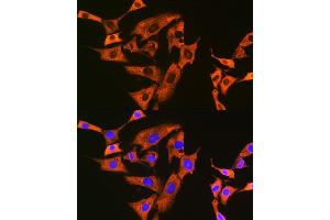 Immunofluorescence analysis of NIH-3T3 cells using UQCRFS1 Rabbit mAb (ABIN7271127) at dilution of 1:100 (40x lens). (UQCRFS1 抗体)