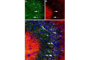 Multiplex staining of DPP6 and KV4. (DPP6 抗体  (C-Term, Extracellular))