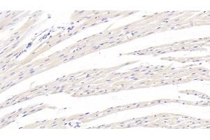 Detection of TGFb1 in Rat Cardiac Muscle Tissue using Monoclonal Antibody to Transforming Growth Factor Beta 1 (TGFb1) (TGFB1 抗体  (AA 279-390))