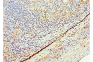 Immunohistochemistry of paraffin-embedded human tonsil tissue using ABIN7172113 at dilution of 1:100 (TK1 抗体  (AA 1-234))