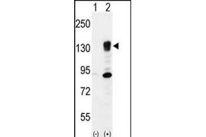 Western blot analysis of ITGA5 (arrow) using rabbit polyclonal ITGA5 Antibody (Center) (ABIN656138 and ABIN2845477). (ITGA5 抗体  (AA 575-602))