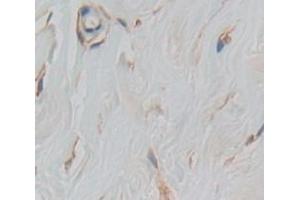 IHC-P analysis of Human Tissue, with DAB staining. (TLR5 抗体  (AA 303-514))