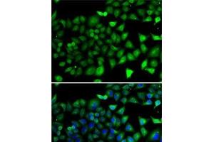 Immunofluorescence analysis of A-549 cells using NFYB Polyclonal Antibody (NFYB 抗体)