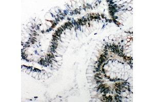 Immunohistochemistry (IHC) image for anti-Tumor Protein P53 Binding Protein 1 (TP53BP1) (AA 1955-1972), (C-Term) antibody (ABIN3044038)