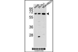 Western blot analysis in Jurkat,ZR-75-1,MDA-MB231 cell line lysates (35ug/lane). (ZSCAN2 抗体  (N-Term))