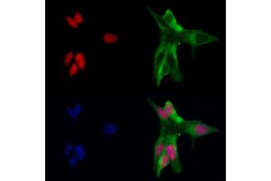 ABIN6263544 and ABIN6266651 staining MCF-7 by IF/ICC. (NCOR1 抗体  (N-Term))