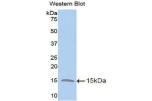 Western Blotting (WB) image for anti-Trefoil Factor 2 (TFF2) (AA 27-128) antibody (ABIN1173507) (Trefoil Factor 2 抗体  (AA 27-128))