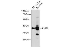 Western blot analysis of extracts of various cell lines, using  Antibody (ABIN6127455, ABIN6137182, ABIN6137185 and ABIN6218131) at 1:1000 dilution. (Asialoglycoprotein Receptor 2 抗体  (AA 131-287))