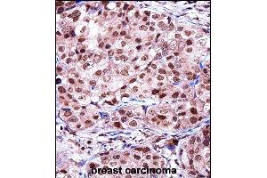 Immunohistochemistry (Paraffin-embedded Sections) (IHC (p)) image for anti-Telomeric Repeat Binding Factor 2, Interacting Protein (TERF2IP) (AA 349-378), (C-Term) antibody (ABIN657968)