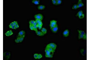 Immunofluorescent analysis of HepG2 cells using ABIN7143381 at dilution of 1:100 and Alexa Fluor 488-congugated AffiniPure Goat Anti-Rabbit IgG(H+L) (BAI2 抗体  (AA 1371-1545))