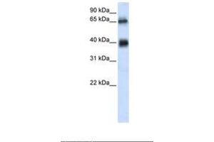 Image no. 1 for anti-Zinc Finger with UFM1-Specific Peptidase Domain (ZUFSP) (AA 254-303) antibody (ABIN6739108) (ZUFSP 抗体  (AA 254-303))