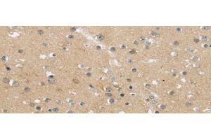 Immunohistochemistry of paraffin-embedded Human brain using MPP6 Polyclonal Antibody at dilution of 1/25 (MPP6 抗体)