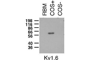 Immunoblot on adult rat brain membrane (RBM) and lysates from Kv1.