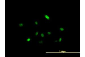 Immunofluorescence of purified MaxPab antibody to ARIH2 on HeLa cell. (ARIH2 抗体  (AA 1-493))