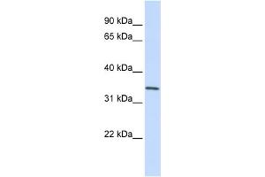 WB Suggested Anti-GNPDA1 Antibody Titration:  0.