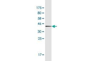 Western Blot detection against Immunogen (37. (HTRA3 抗体  (AA 344-453))