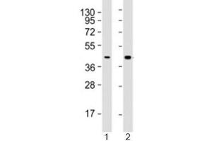 Western blot testing of human 1) HepG2 (liver carcinoma line) and 2) liver lysate with AGXT antibody at 1:2000. (AGXT 抗体  (AA 188-375))