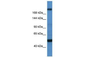 WB Suggested Anti-TCF20 Antibody Titration:  0.