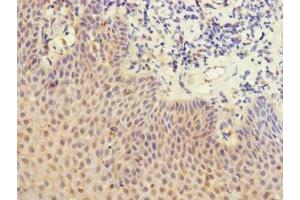 Immunohistochemistry of paraffin-embedded human tonsil tissue using ABIN7158638 at dilution of 1:100 (LY75/DEC-205 抗体  (AA 440-680))