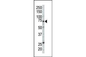 Western Blotting (WB) image for anti-V-Raf-1 Murine Leukemia Viral Oncogene Homolog 1 (RAF1) (AA 1-30), (N-Term) antibody (ABIN392261)