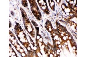 IHC-P: Caspase-6 antibody testing of rat intestine tissue (Caspase 6 抗体  (AA 7-27))