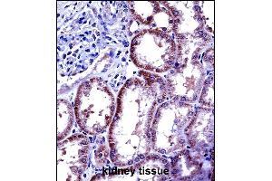 IL6 Antibody (Center) ((ABIN656406 and ABIN2845700))immunohistochemistry analysis in formalin fixed and paraffin embedded human kidney tissue followed by peroxidase conjugation of the secondary antibody and DAB staining. (IL-6 抗体  (AA 27-55))