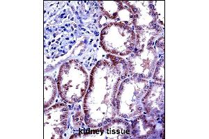 IL6 Antibody (Center) ((ABIN656406 and ABIN2845700))immunohistochemistry analysis in formalin fixed and paraffin embedded human kidney tissue followed by peroxidase conjugation of the secondary antibody and DAB staining.