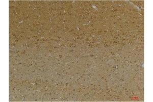 Immunohistochemistry (IHC) analysis of paraffin-embedded Rat Brain Tissue using KCNK9 (TASK-3) Rabbit Polyclonal Antibody diluted at 1:200. (KCNK9 抗体)