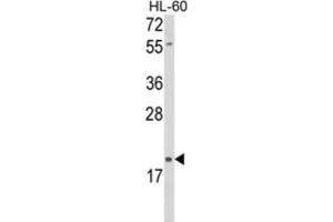 Western Blotting (WB) image for anti-delta-Like 2 Homolog (DLK2) antibody (ABIN5024466) (DLK2 抗体)