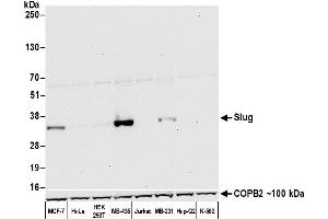 Western Blotting (WB) image for anti-Snail Family Zinc Finger 2 (SNAI2) (AA 75-125) antibody (ABIN7452582)