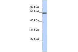 WB Suggested Anti-ANTXR1 Antibody Titration:  0. (ANTXR1 抗体  (Middle Region))
