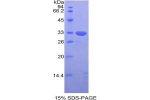 SDS-PAGE analysis of Human KIR2DS4 Protein. (KIR2DS4 蛋白)