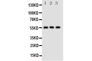 Western Blotting (WB) image for anti-Solute Carrier Family 2 (Facilitated Glucose/fructose Transporter), Member 5 (SLC2A5) (AA 232-251), (Middle Region) antibody (ABIN3044131) (SLC2A5 抗体  (Middle Region))
