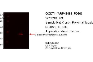 Western Blotting (WB) image for anti-3-Oxoacid CoA Transferase 1 (OXCT1) (Middle Region) antibody (ABIN2783388) (OXCT1 抗体  (Middle Region))