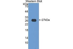Western Blotting (WB) image for anti-Transglutaminase 3 (E Polypeptide, Protein-Glutamine-gamma-Glutamyltransferase) (TGM3) (AA 468-693) antibody (ABIN1078610) (TGM3 抗体  (AA 468-693))