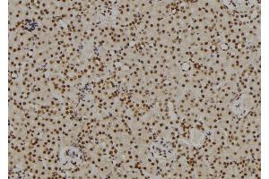 ABIN6269101 at 1/100 staining Rat kidney tissue by IHC-P. (Retinoblastoma 1 抗体  (C-Term))