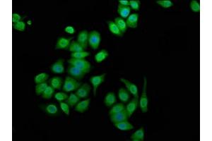 Immunofluorescence staining of PC-3 cells with ABIN7144251 at 1:100, counter-stained with DAPI. (Ankyrin G 抗体  (AA 3540-3719))