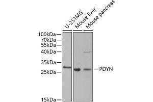 Western blot analysis of extracts of various cell lines, using PDYN antibody (ABIN6129606, ABIN6145418, ABIN6145419 and ABIN6221524) at 1:1000 dilution. (PDYN 抗体  (AA 21-254))