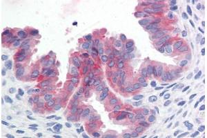Human Uterus (formalin-fixed, paraffin-embedded) stained with c-Met antibody ABIN351534 at 10 ug/ml followed by biotinylated anti-mouse IgG secondary antibody ABIN481714, alkaline phosphatase-streptavidin and chromogen. (c-MET 抗体  (Cytoplasmic Domain))