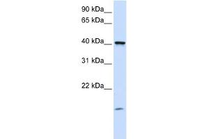 WB Suggested Anti-TMEM79 Antibody Titration:  0. (TMEM79 抗体  (C-Term))