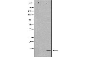 Western blot analysis of extracts of Jurkat, using MIF antibody. (MIF 抗体  (C-Term))