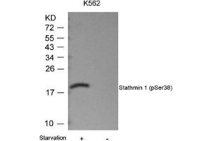 Western blot analysis of extracts from K562 cells untreated or treated with starvation using Stathmin 1(Phospho-Ser38) Antibody. (Stathmin 1 抗体  (pSer38))
