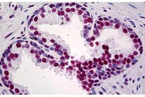 Human Prostate: Formalin-Fixed, Paraffin-Embedded (FFPE) (KAP1 抗体  (AA 379-524))