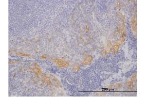 Immunoperoxidase of purified MaxPab antibody to KRT19 on formalin-fixed paraffin-embedded human tonsil.